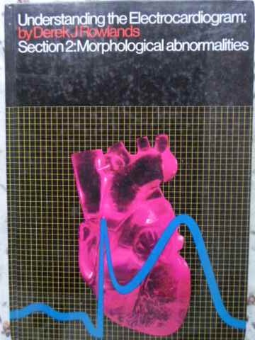 Vezi detalii pentru Understanding The Electrocardiogram: Section 2: Morphological Abnormalities