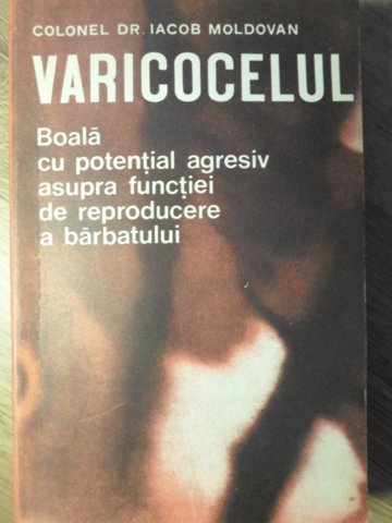 Varicocelul, Boala Cu Potential Agresiv Asupra Functiei De Reproducere A Barbatului