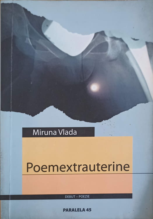 Vezi detalii pentru Poemextrauterine