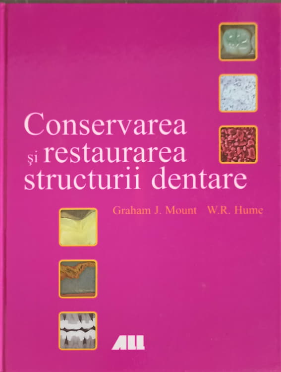 Conservarea Si Restaurarea Structurii Dentare