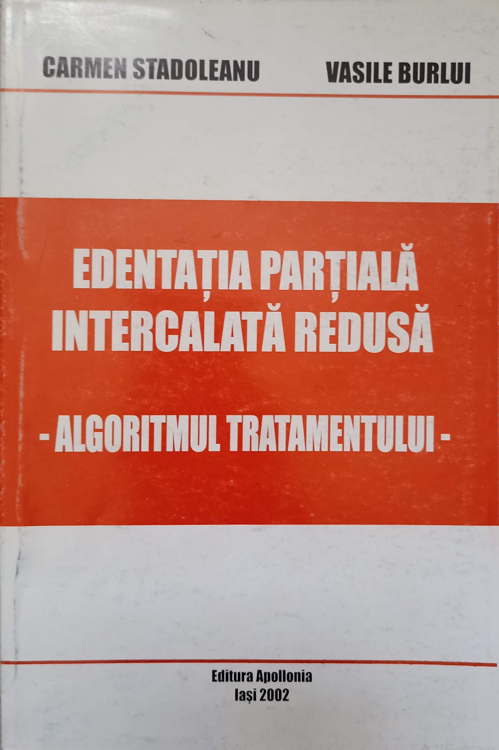 Vezi detalii pentru Edentatia Partiala Intercalata Redusa. Algoritmul Tratamentului