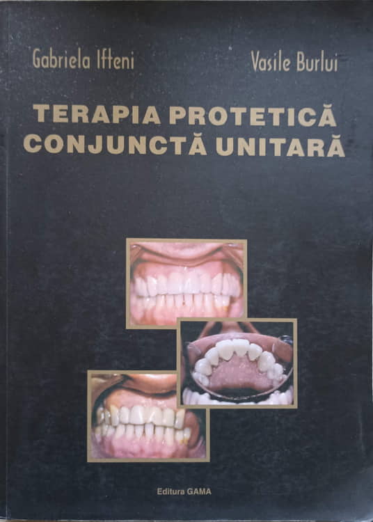 Terapia Protetica. Conjuncta Unitara